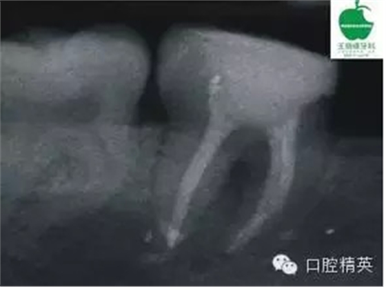 QQ图片20150710104027.png
