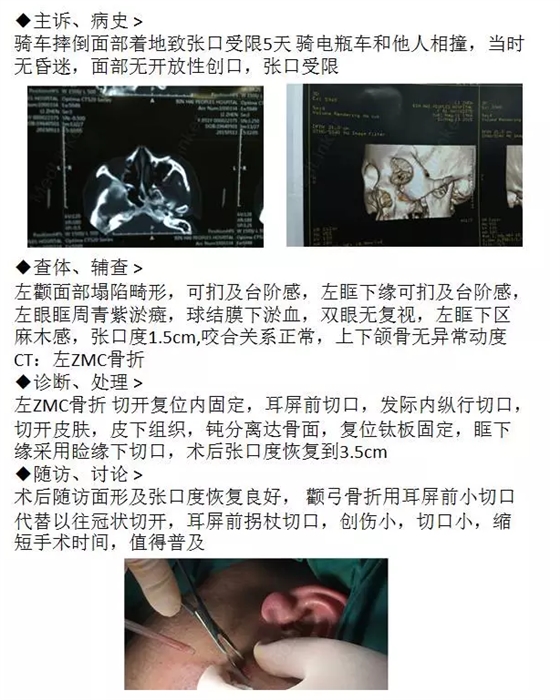QQ图片20150717105517.png
