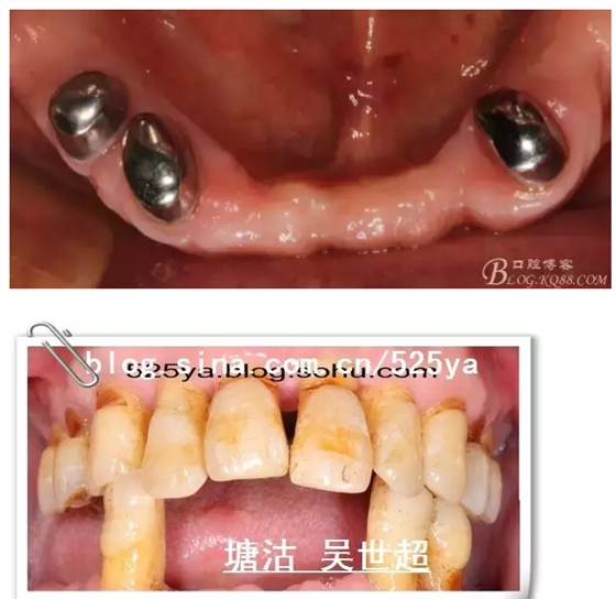 QQ图片20150728084620.png