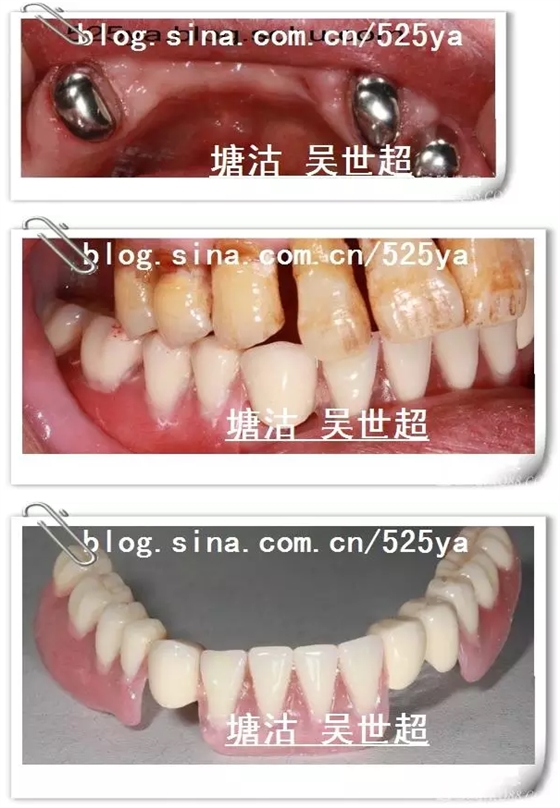 QQ图片20150728084634.png