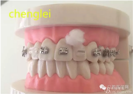 QQ图片20150808171257.png