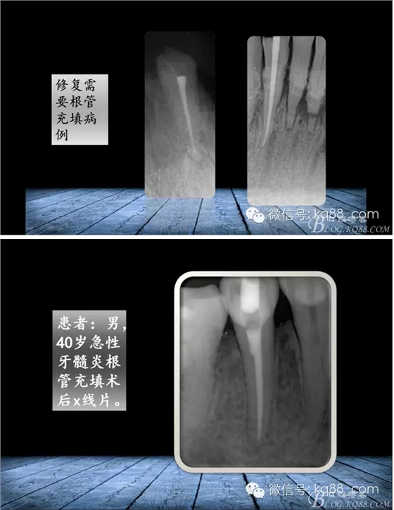 QQ图片20150817140856.png
