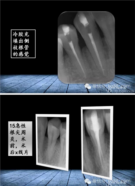 QQ图片20150817141250.png