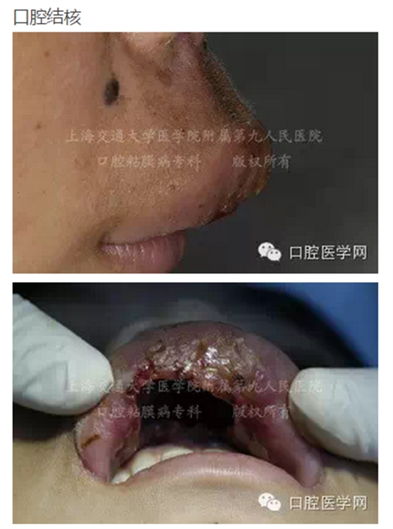 QQ图片20150824140730.png