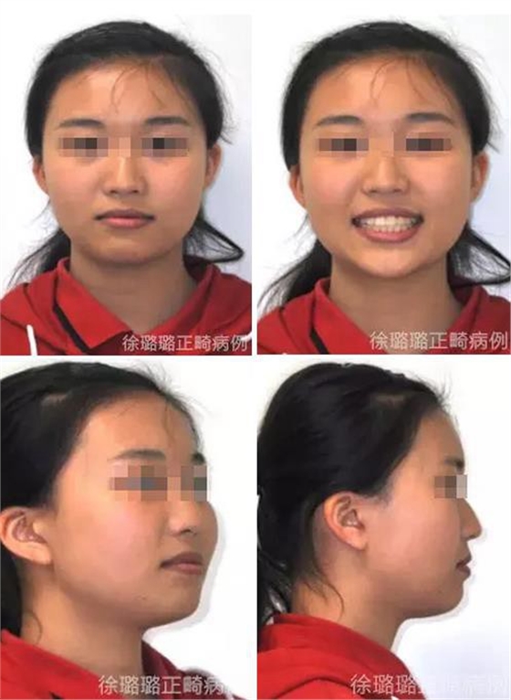 360截图20170120124847282.jpg
