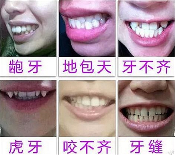 “发现即矫正”12岁前必须处理的20种儿童牙颌畸形 