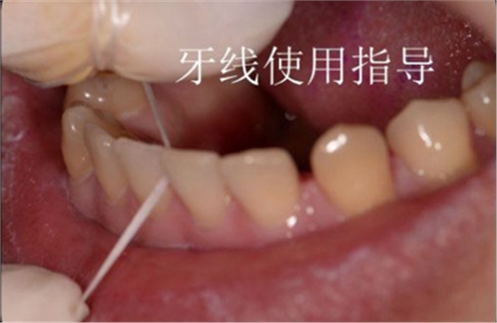 99%的人都不知道怎样才算把牙齿刷干净了！