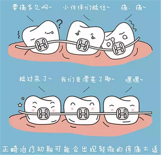 牙齿正畸过程中需注意哪些事项？