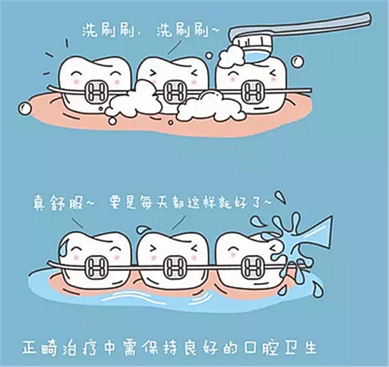 牙齿正畸过程中需注意哪些事项？