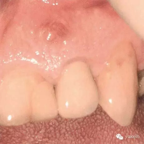 QQ图片20150711143954.png QQ图片20150711143954.png