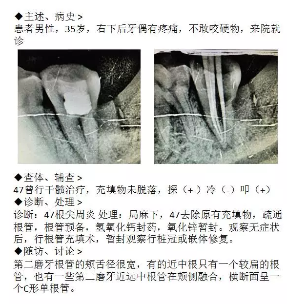 QQ图片20150717110007.png