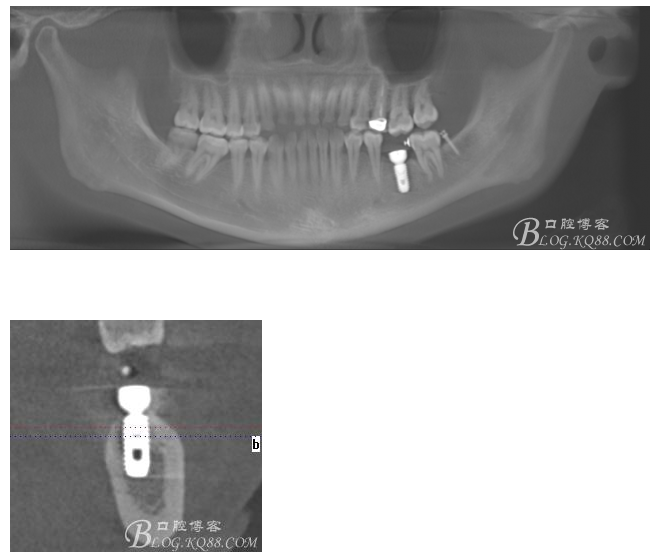 QQ图片20150721091740.png