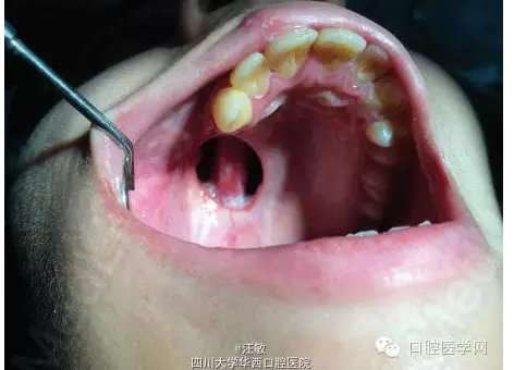 QQ图片20150727142401.png