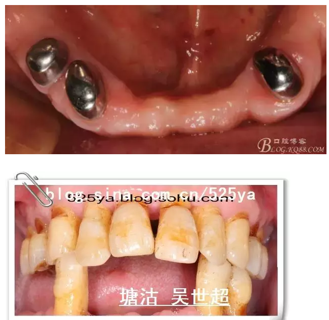 QQ图片20150728084620.png