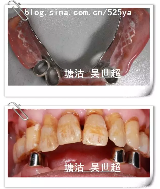 QQ图片20150728084700.png