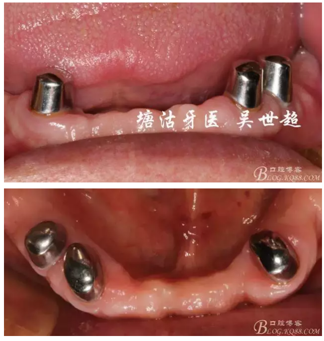 QQ图片20150728084915.png
