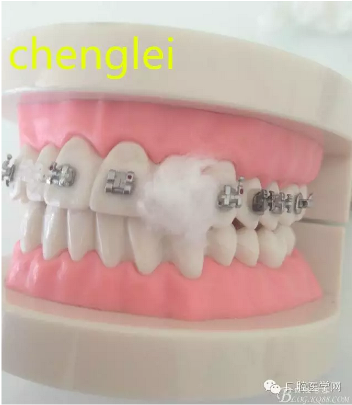 QQ图片20150808171313.png