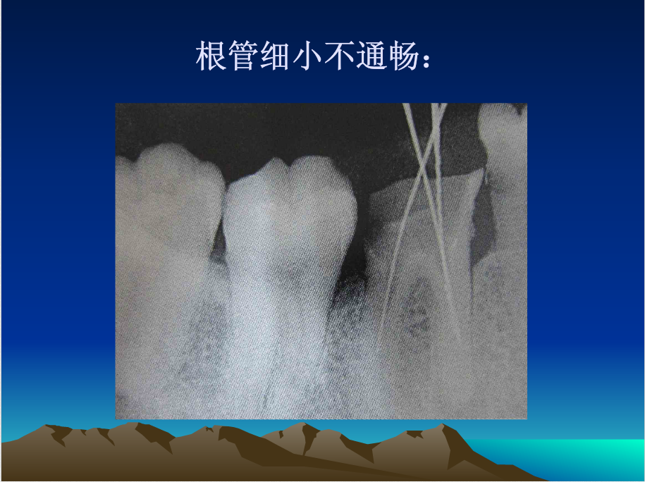 QQ图片20150818154402.png