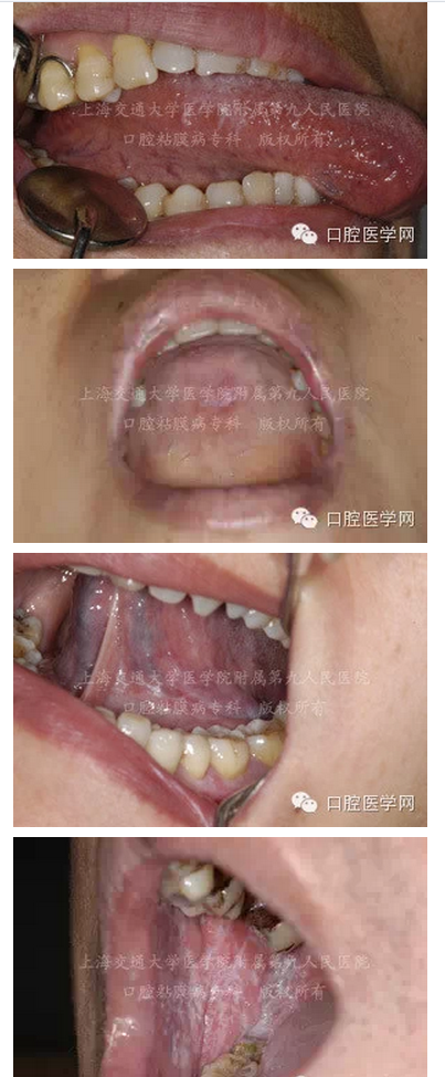 QQ图片20150824140636.png