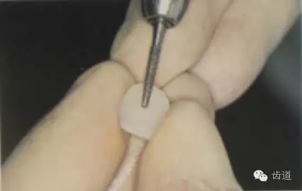 瓷贴面的粘接步骤及技术要点