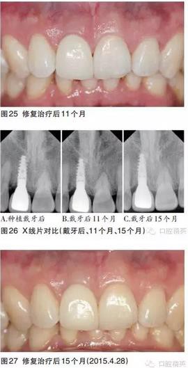 360截图20170122104028150.jpg