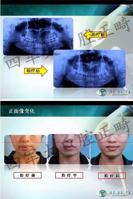 360截图20170124150440419.jpg