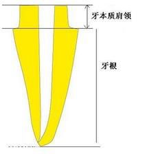 纤维桩临床操作步骤