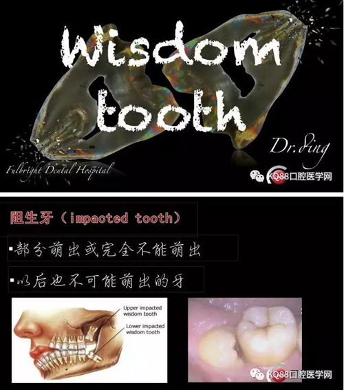 智齿拔除