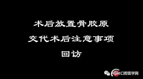 智齿拔除