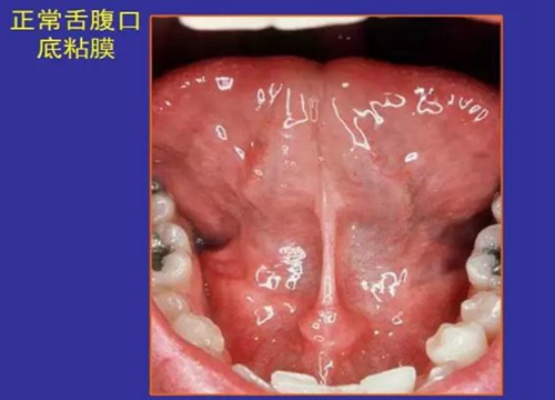 正常口腔黏膜及常见病损图