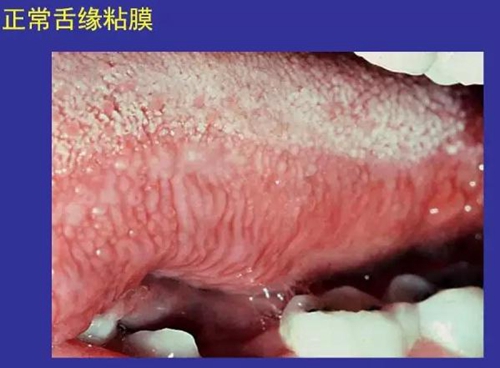 正常口腔黏膜及常见病损图