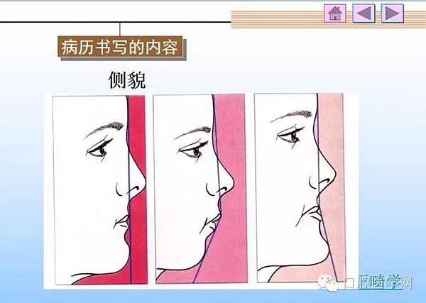 口腔正畸学病历书写  