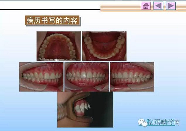 口腔正畸学病历书写  