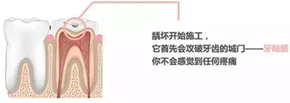 【收藏】关于补牙，知道这些就够了！