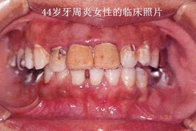 上海品瑞迈格磁致伸缩治疗仪