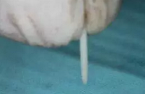 纤维桩修复之精细操作