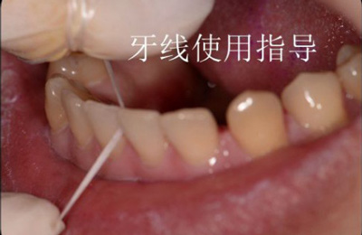 99%的人都不知道怎样才算把牙齿刷干净了！