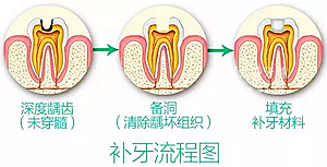 你总嚷着看牙“贵”还不是你自己造成的