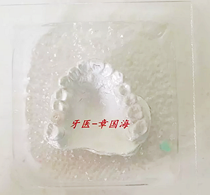 种植导板制作
