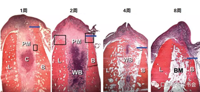 血液衍生物PRF&CGF在牙槽窝处理中的应用