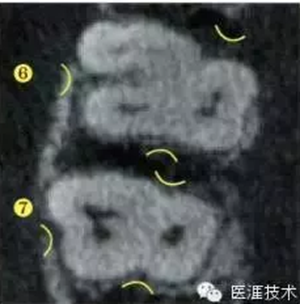 【牙周外科】牙齿的解剖形态（上篇）