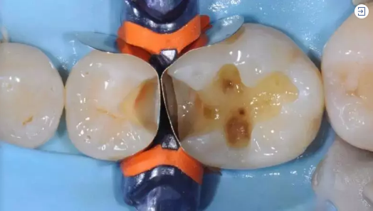 居家牙科急症指南