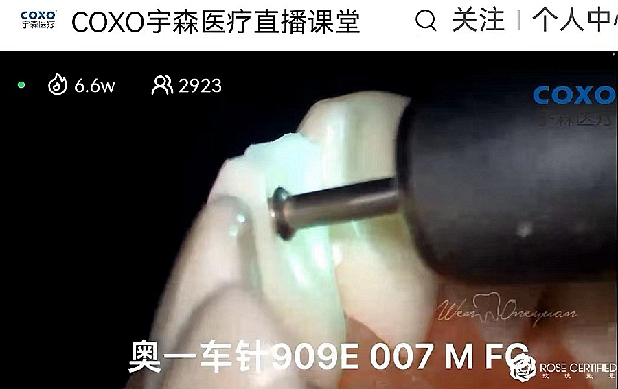 德国奥一定深车针