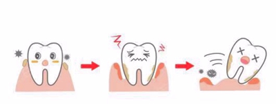 牙周病总是来势汹汹？有办法预防吗？