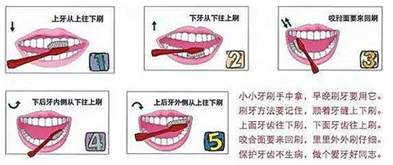 牙周病患者的外提升 梁光强
