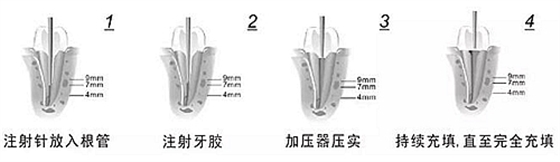 新热熔充填系统C-Fill