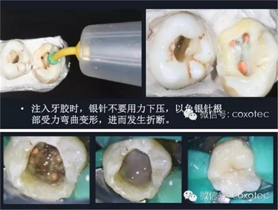 新热熔充填系统C-Fill