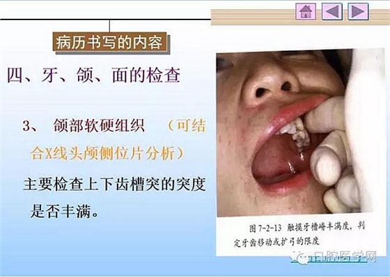 口腔正畸学病历书写  