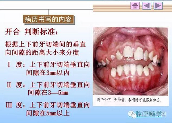 口腔正畸学病历书写  